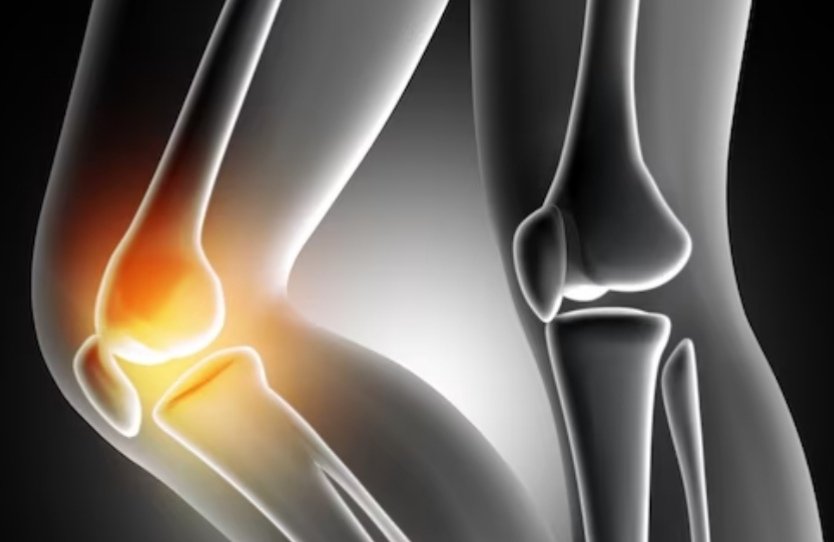 Arthritis: Types and Treatment Options