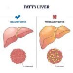 Unveiling Clinical Tests for the Diagnosis of Liver Diseases