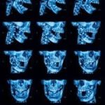 Histopathology of Odontogenic Tumors