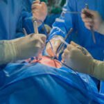 Essential Recovery Tips After Heart Surgery