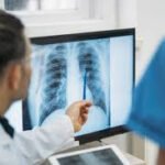 Lung Cancer: Causes, Symptoms, and Prevention