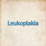 Leukoplakia: Causes, Symptoms, and Treatment