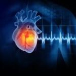Coronary Artery Disease: Symptoms, Causes, and Prevention