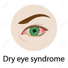 Dry Eye Syndrome: Causes, Symptoms, and Treatment