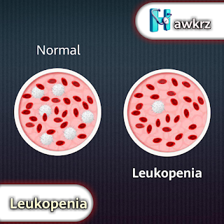 Leukopenia: Causes, Symptoms, and Treatment Options