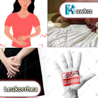 Leukorrhea: Causes, Symptoms, and Treatment Options