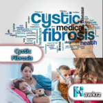 Cystic Fibrosis: Symptoms, Causes, and Treatment Options