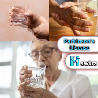 Parkinson’s Disease: Symptoms, Causes, and Treatment Strategies