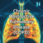 COPD Causes, Symptoms, and Management