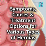 Symptoms, Causes, and Treatment Options for Various Types of Hernias