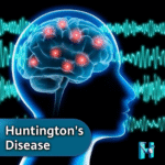 Signs, Symptoms, and Treatment Options of Huntington’s Disease