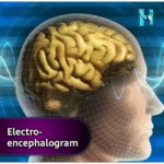 Decoding the Mysteries of Brain Waves through EEG